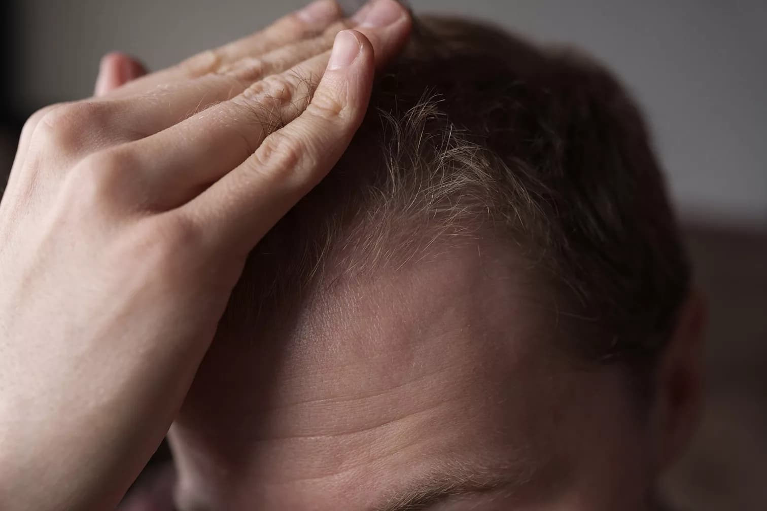 The North East Guide to Finding Hair Loss Treatment Options